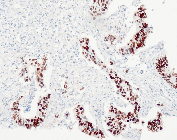 p53 (QR025) Rb 0,5 ml konsentraatti