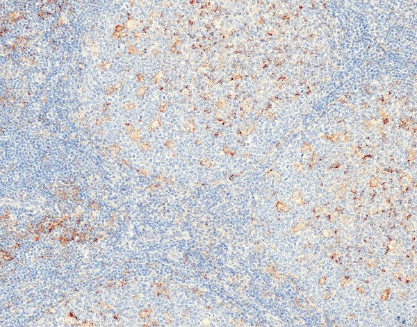 PD-L1 (QR001) Rb 0,5 ml konsentraatti