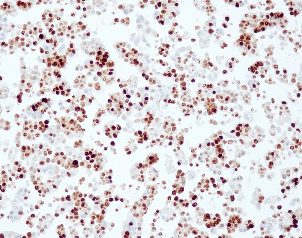 Progesterone Receptor (QR014) Rb 0,5 ml konsentraatti