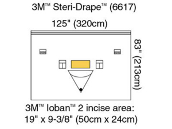 Vertikallakan Ioban2 213x320cm steril med påsar och incisionsfilm
