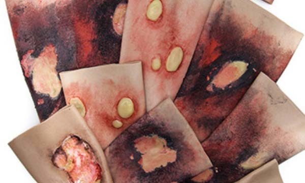 Trauma FX - Simsleeve - Arm - Full Thickness Burn