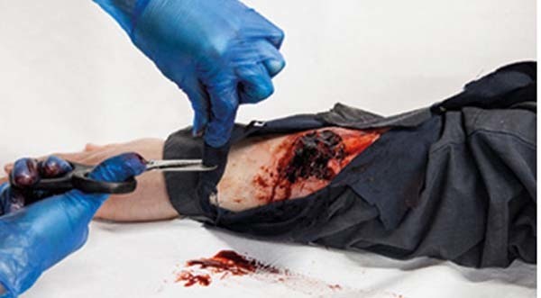 Trauma FX - Simsleeve - Arm - Major Wound