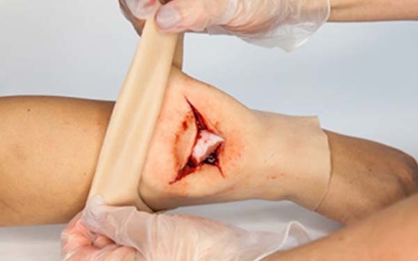 Trauma FX - Simsleeve - Arm - Open Fracture