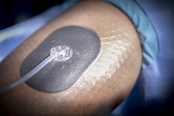 V.A.C.® Peel and Place Dressing Kit, med sensatrac, steril, medium