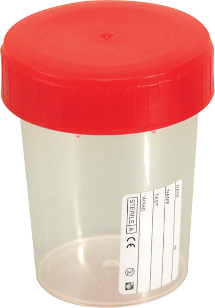 Urinprøveglass m/lokk 180ml